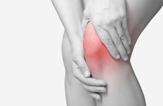 Frau mit Kniearthrose